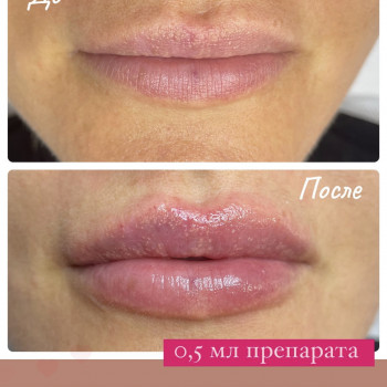 Наталья Татарчук, Одеса Фото - 4