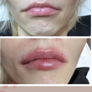 Наталья Татарчук, Одеса Фото - 5