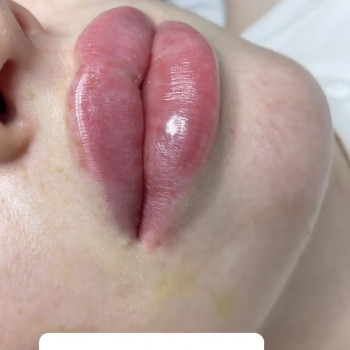 Наталья Татарчук, Одеса Фото - 6