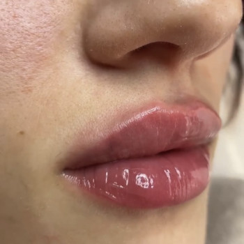 Наталья Татарчук, Одеса Фото - 7