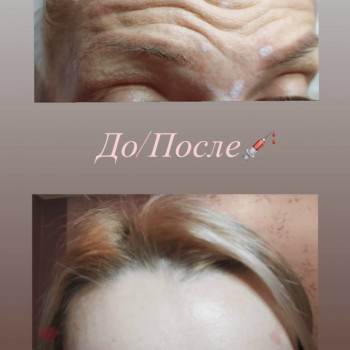 Наталья Татарчук, Одеса Фото - 8