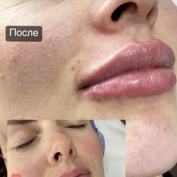 Наталья Татарчук, Одеса Фото - 9