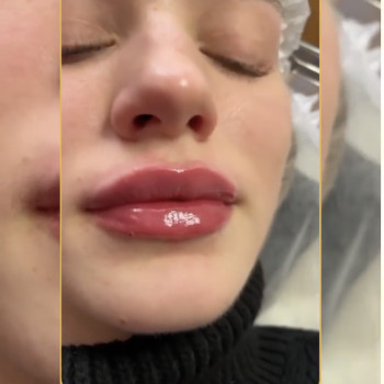 Наталья Татарчук, Одеса Фото - 10