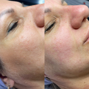 Катерина Романчук, Київ Фото - 45