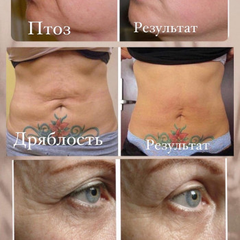 Диана Салова, Киев Фото - 7