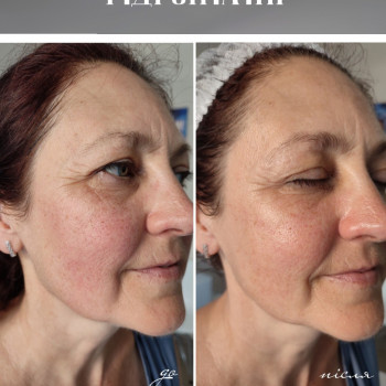 Алла Яценко, Кременчук Фото - 16