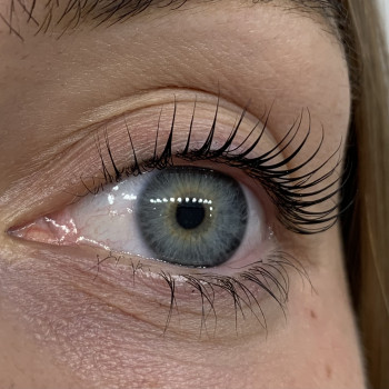 Альона Ковальчук, Буча Фото - 5