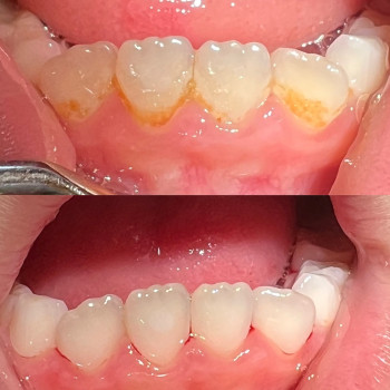 до та після