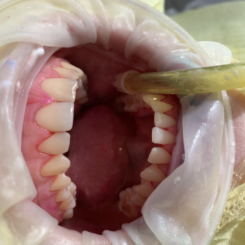 Професійна гігієна
                    Стоматологическая клиника  Винница