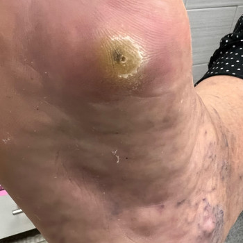 Вікторія Житня, Харків Фото - 41