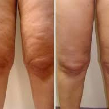 Алена Борзунова, Харьков Фото - 5