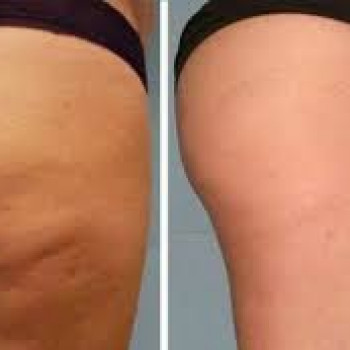 Алена Борзунова, Харьков Фото - 6