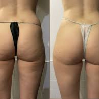 Алена Борзунова, Харьков Фото - 7