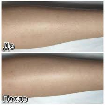 Алена Борзунова, Харьков Фото - 8