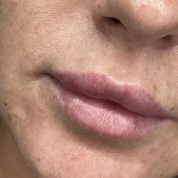 Контурна пластика губ
                    Мастер перманентного макияжа Вита Одесса