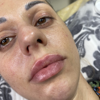 Контурна пластика губ
                    Мастер перманентного макияжа Вита Одесса