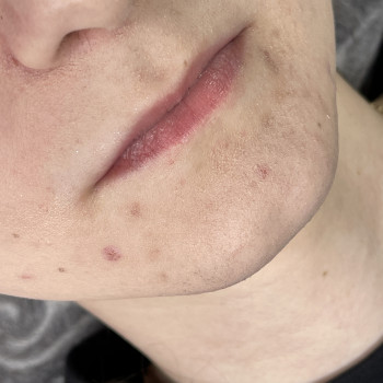 Контурна пластика губ
                    Мастер перманентного макияжа Вита Одесса