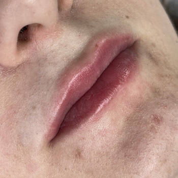 Контурна пластика губ
                    Мастер перманентного макияжа Вита Одесса