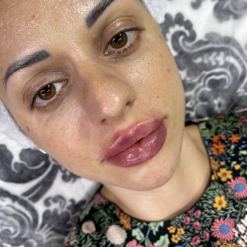 Контурна пластика губ
                    Мастер перманентного макияжа Вита Одесса