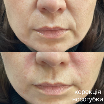 Світлана Юревич, Киев Фото - 15