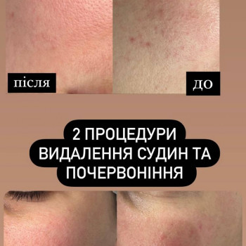 Боніта, Хмельницкий Фото - 11