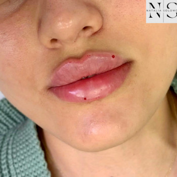 Наталия Соло, Житомир Фото - 8