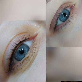 Заповнення міжвійного простору