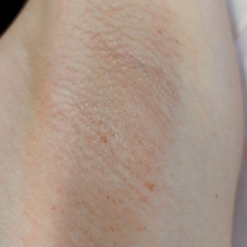 Світлана Галузінська, Одеса Фото - 5