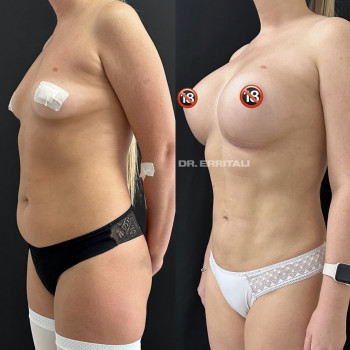 Абдель Эрритали, Харків Фото - 59