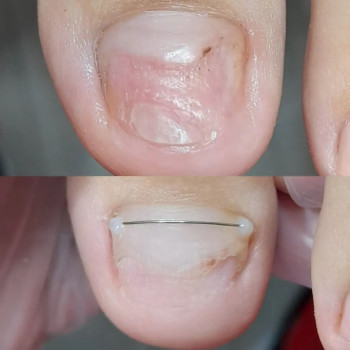 Анна Мудра, Запорожье Фото - 6