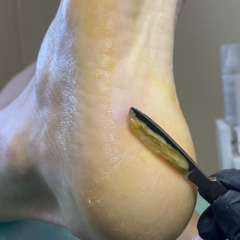 Елена Савченко, Днепр Фото - 29