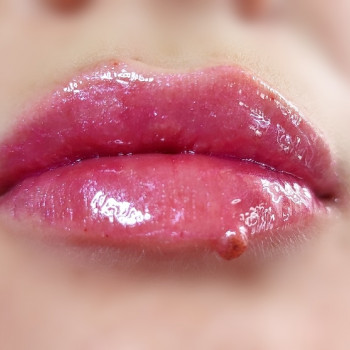 Аргументація губ препарат нейрамис