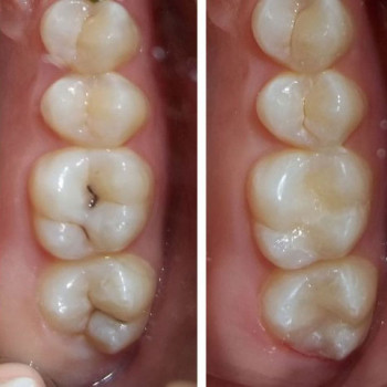 Христина Товарянська, Львів Фото - 5