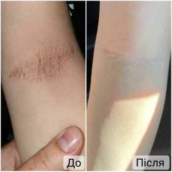 Ганна Філоненко, Кременчук Фото - 5