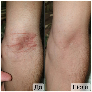 Ганна Філоненко, Кременчук Фото - 6