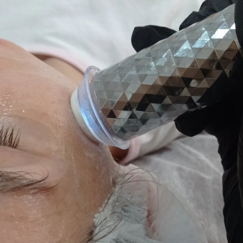 апаратна карбоксотерапія