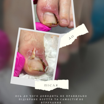 Фото из портфолио специалиста Татьяна Вакула (подолог, Харьков)