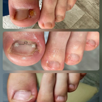   ніготь
  ноготь
 
 