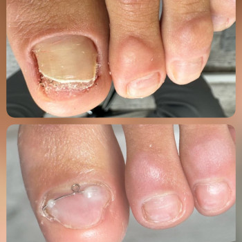   нігтів
  ногтей
 
  ніготь
  ноготь
 
 