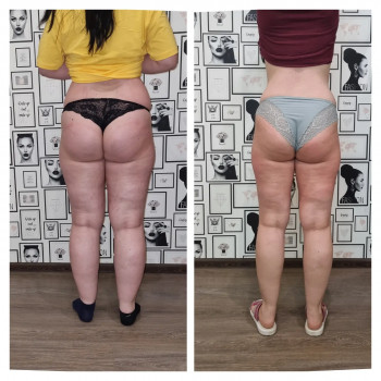 Тетяна Лившенко, Кам'янське Фото - 5