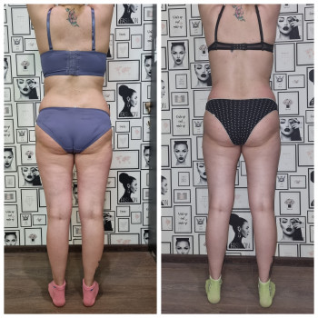 Тетяна Лившенко, Кам'янське Фото - 7