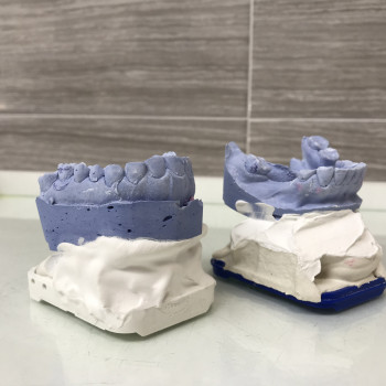 незнімний протез