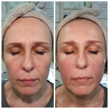 Авторський масаж обличчя
                    Салон красоты Body and face sculpture Киев