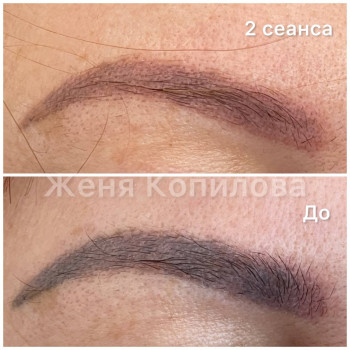 Проміжковий результат курсу. Рухаємося до чистої шкіри