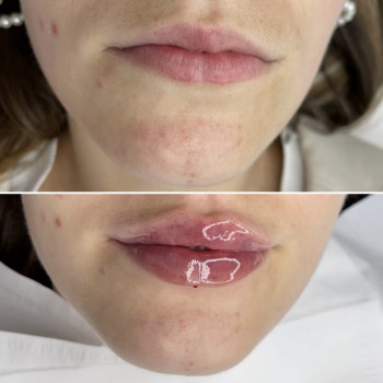 Яна Саманчук, Киев Фото - 6