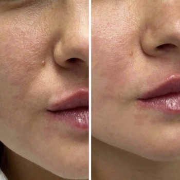 Ольга Друченко, Київ Фото - 11