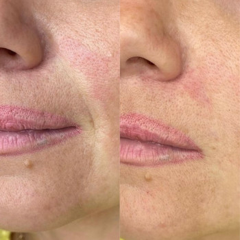 Ольга Друченко, Київ Фото - 10