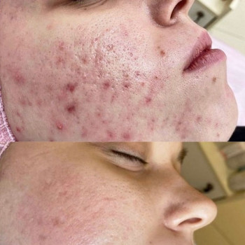 Ольга Друченко, Київ Фото - 9