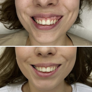 Ольга Друченко, Київ Фото - 7