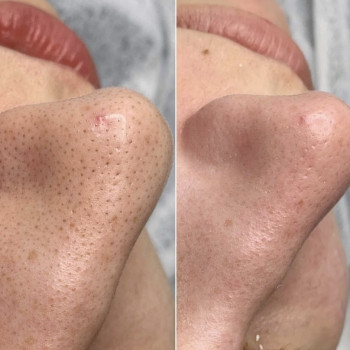 Ольга Друченко, Київ Фото - 6